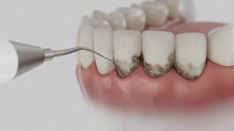 Trusted Emergency Dentist service in Isla Vista, CA - Dentist Open Now